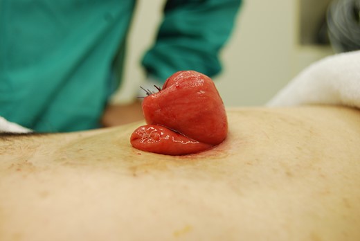 The operation was completed.