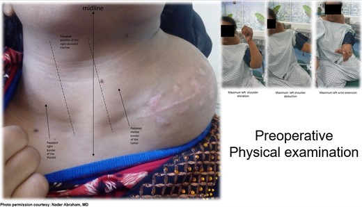 Pre-operative physical examination of the neck and left shoulder.
