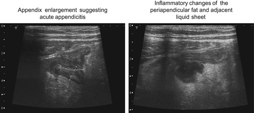 Ultrasound findings.