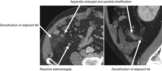 CT scan findings.