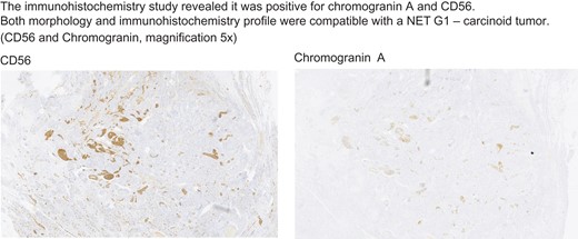 Immunohistochemistry of the appendix.