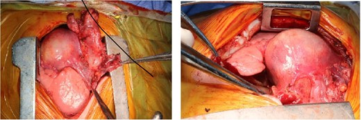 Operative photograph.