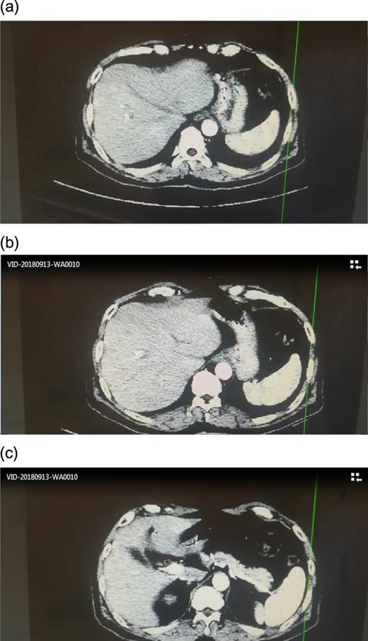 CT scan.