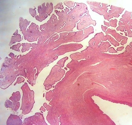 Intersection where the extrusion component is shown (H&E × 20).