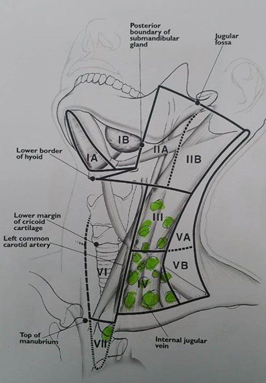 Cervical lymph node mapping.