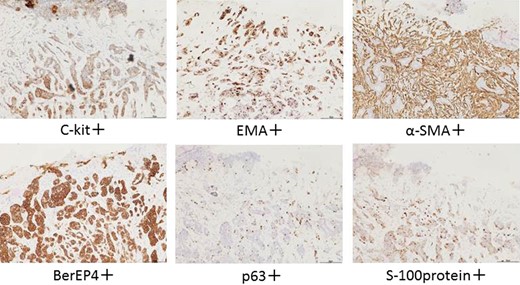 Immunohistochemical views in six different stains.