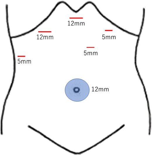 The schema demonstrates the placement of each port.
