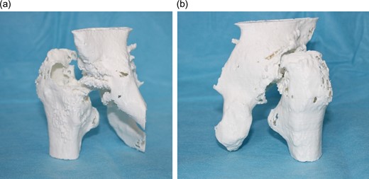 a) Life-size 3D model (anterior vi6ew). (b) Life-size 3 model (posterior view).