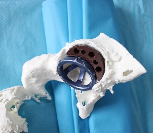 Augment probe testing.