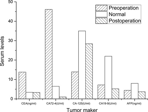 Changes in serum tumor maker levels. Carcinoembryonic antigen (CEA) and carbohydrate antigen 72-4 (CA72-4) levels were elevated preoperatively but were restored to the normal levels postoperatively. Carbohydrate antigen 125 (CA-125), carbohydrate antigen 19-9 (CA19-9), and alpha-fetoprotein (AFP) were normal both before and after surgery.