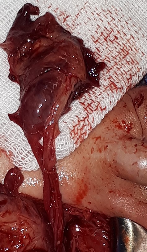 The right testicle showed evidence of ischemia and bluish discoloration.