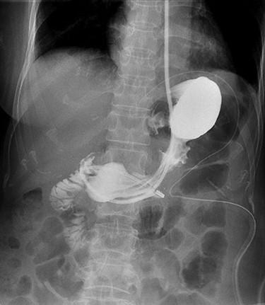 POD 5 water-soluble contrast study image.