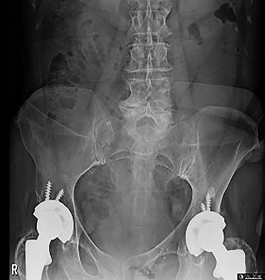 Abdominal film showing nonspecific bowel pattern.