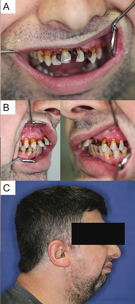 Clinical situation at first presentation.