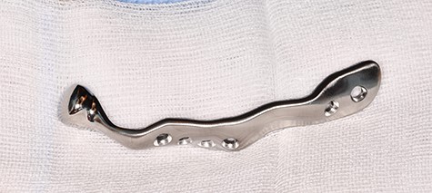 Patient-specific TMJ implant of the right side (Zimmer Biomet Holdings, Warsaw, Indiana, USA).