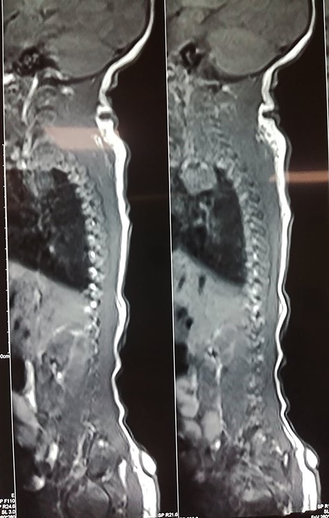 MRI showing connection with soft tissue.