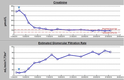 Admission blood panel demonstrating an acute kidney injury with rapid normalization of renal function following insertion of bilateral ureteric stenting (timing indicated by blue arrow).