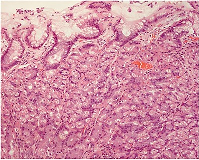 Fundic (oxyntic) gastric gland mucosa (hematoxylin and eosin; ×100).