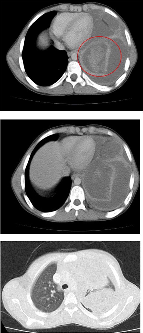 Chest CT.