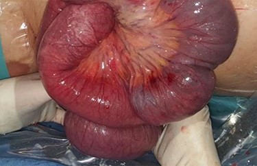 Recovery from initial ischemia.