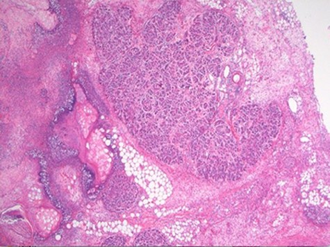 Lobulated pancreatic tissue (H&E stain, x100).