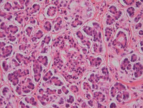 Islet of Langerhans (H&E stain, x400).
