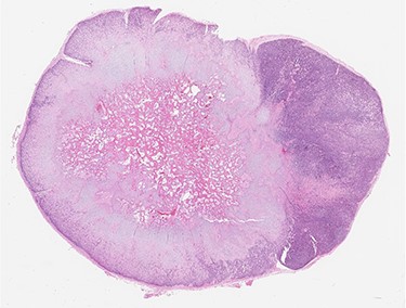 Low-power view of the lesion showing central ossification (H&E).