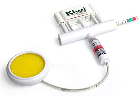 A Kiwi® OmniCup obstetrics delivery device.