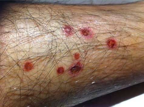 Two weeks after test.