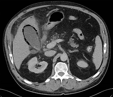 Axial CT image.