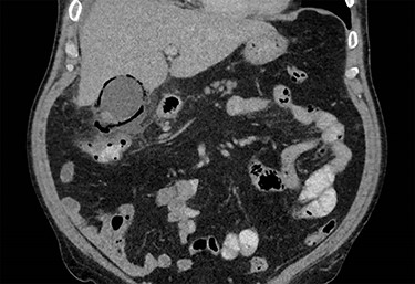 Coronal CT image.