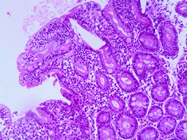 Compatible with Grade B2 on the new grading system for CD classification.