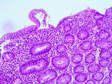 Compatible with Grade B2 on the new grading system for CD classification.