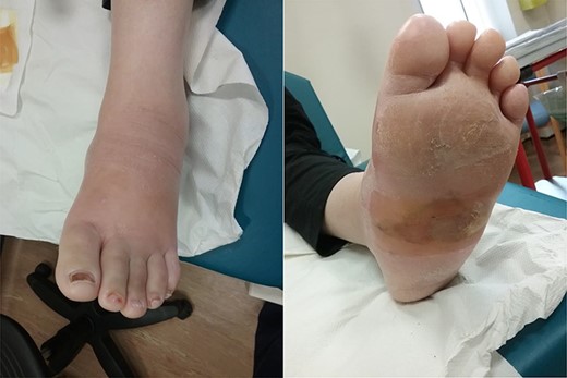 Photographs taken at time of acute presentation.