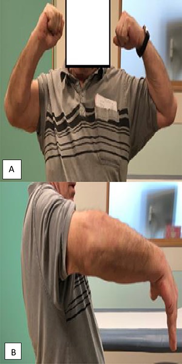Clinical assessment of the post-operative ROM (A and B).