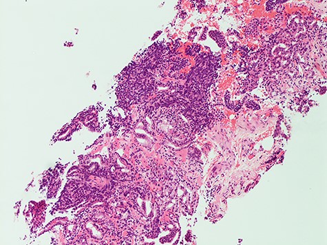 Histology (hematoxylin and eosin (H&E)).