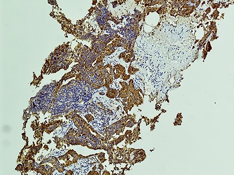 Immunohistochemistry (PSA staining).