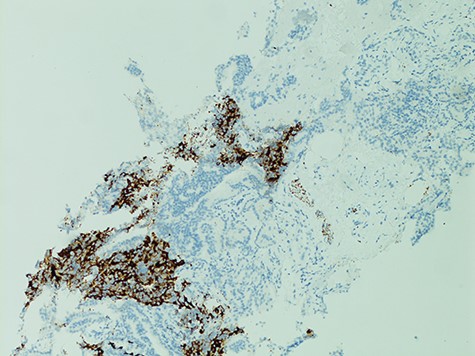 Immunohistochemistry (synaptophysin staining).