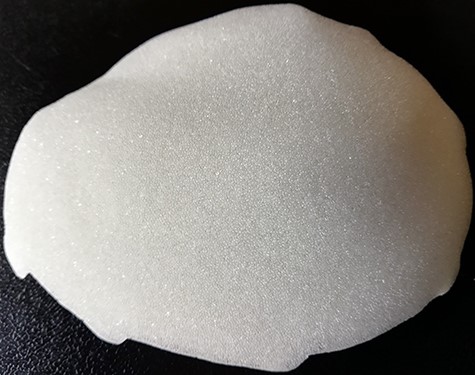 Model of a CAD/CAM non-resorbable biocompatible cranioplasty (Biomet, Germany) composed of polymethylmethacrylate (PMMA) spherical macro beads coated and fused with polyhydroxyethylmethacrylate (PMHA).