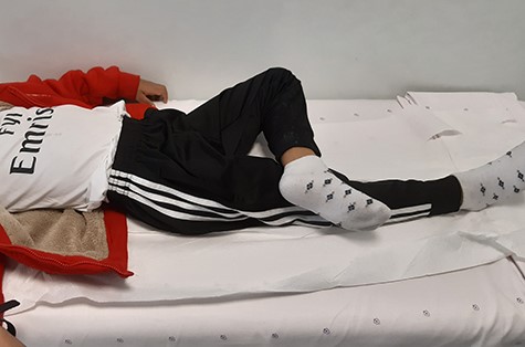 Showed external rotation of the left hip joint.