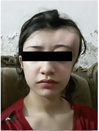 Patient pre-operation.