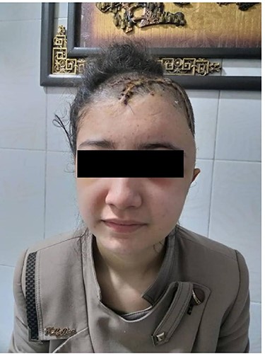 Patient post-operation.