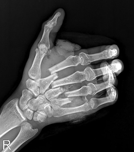 X-ray radiograph in the emergency room.