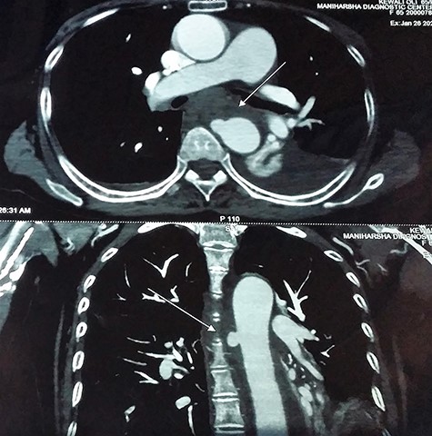 CE-CT image, transverse section.