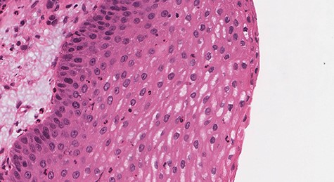 Squamous epithelial cells (H&E stain; ×400).