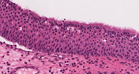 Ciliated columnar cells (H&E stain; ×400).