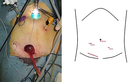 The three port sites and their dimensions.