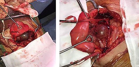 Intraoperative view.