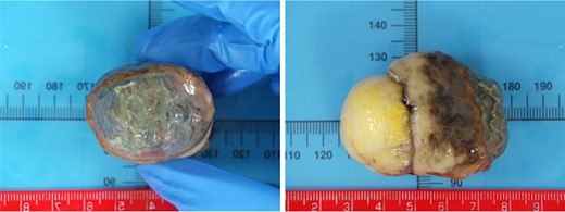 Pathology: visual representation of specimen.