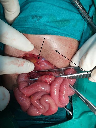 Photograph showing gastric perforation and abdominal distension (arrows).